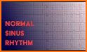 ECG Report related image