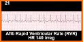 ECG Stat related image