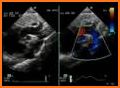 ECHOCARDIOGRAPHY GUIDE related image