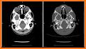 CT Passport Head/Brain / sectional anatomy / MRI related image