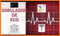 Tutor del ECG Ritmo related image