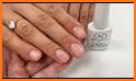 Nail Rescue related image