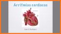 Electrocardiograma ECG Tipos related image