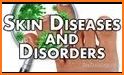 Diseases and Disorders related image