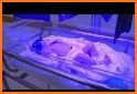 BiliMate • Neonatal Jaundice related image