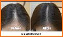 Hair fall control and growth related image