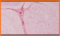 Pathology Review Quiz related image