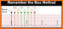 Electrocardiogram ECG Types related image