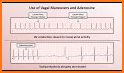 EKG DDX related image