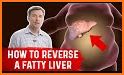 Liver Health related image