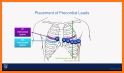 ECG Check related image