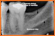 Radiographic Anatomy X-Ray related image