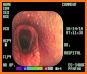 Equine Upper Respiratory Tract Guide related image