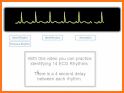 ACLS Rhythm Quiz related image