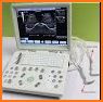 Abdominal Ultrasound pc related image