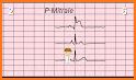 ECG Run - gamify ECG learning and EKG training related image