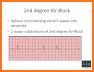 Easy Arrhythmias related image