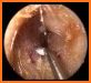 Ear Spy Pro : Live deep hearing related image