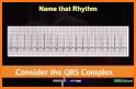 ECG  Interpretation and Tests. related image