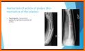 Oxford Handbook of Ortho Traum related image