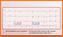 EKG Detective related image