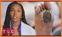 Ladybug Foot Care - The Foot Doctor related image