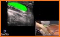 Ultrasound GUIDE - Free Library related image