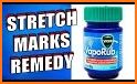 Get rid of STRETCH MARKS - Home Remedies related image