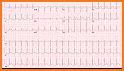 Park Pediatr Cardio Handbook 5 related image