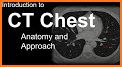 CT Passport Chest / sectional anatomy / MRI related image