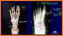 Radiographic Anatomy X-Ray related image