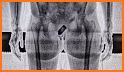 Full body scanner-Xray scanner related image