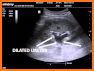 Ultrasound cases + related image