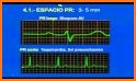 Electrocardiograma ECG Tipos related image