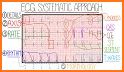 easy ECG training related image