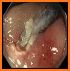 EndoscopyNow related image