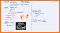 ULTRASOUND GALLBLADDER AND PHATOLOGY related image