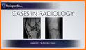 musculoskeletal x-ray interpretation related image