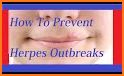 How to Prevent Herpes related image