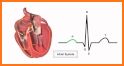 Electrocardiogram ECG Types related image