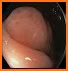 EndoscopyNow related image