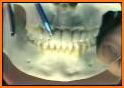 Dental  Anatomy related image