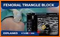 NYSORA Nerve Blocks related image