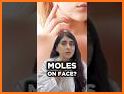 Avoid Mole related image