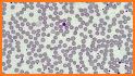 WBC Counter - White Blood Cells differential Count related image