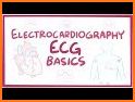 ECG FlashCards related image