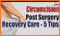 Real Circumcision Surgery Simulator related image