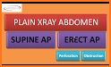 Easy Abdominal X-Ray related image