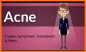 Acne: Causes, Treatment, And Tips related image