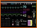 Tutor del ECG Ritmo related image